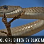 school girl bitten by black mamba